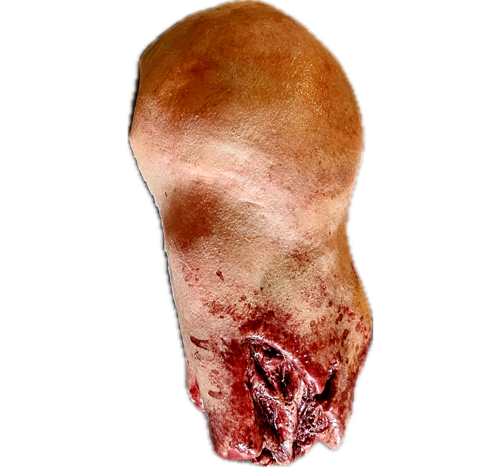 Amputated Upper Arm Prosthetic #101