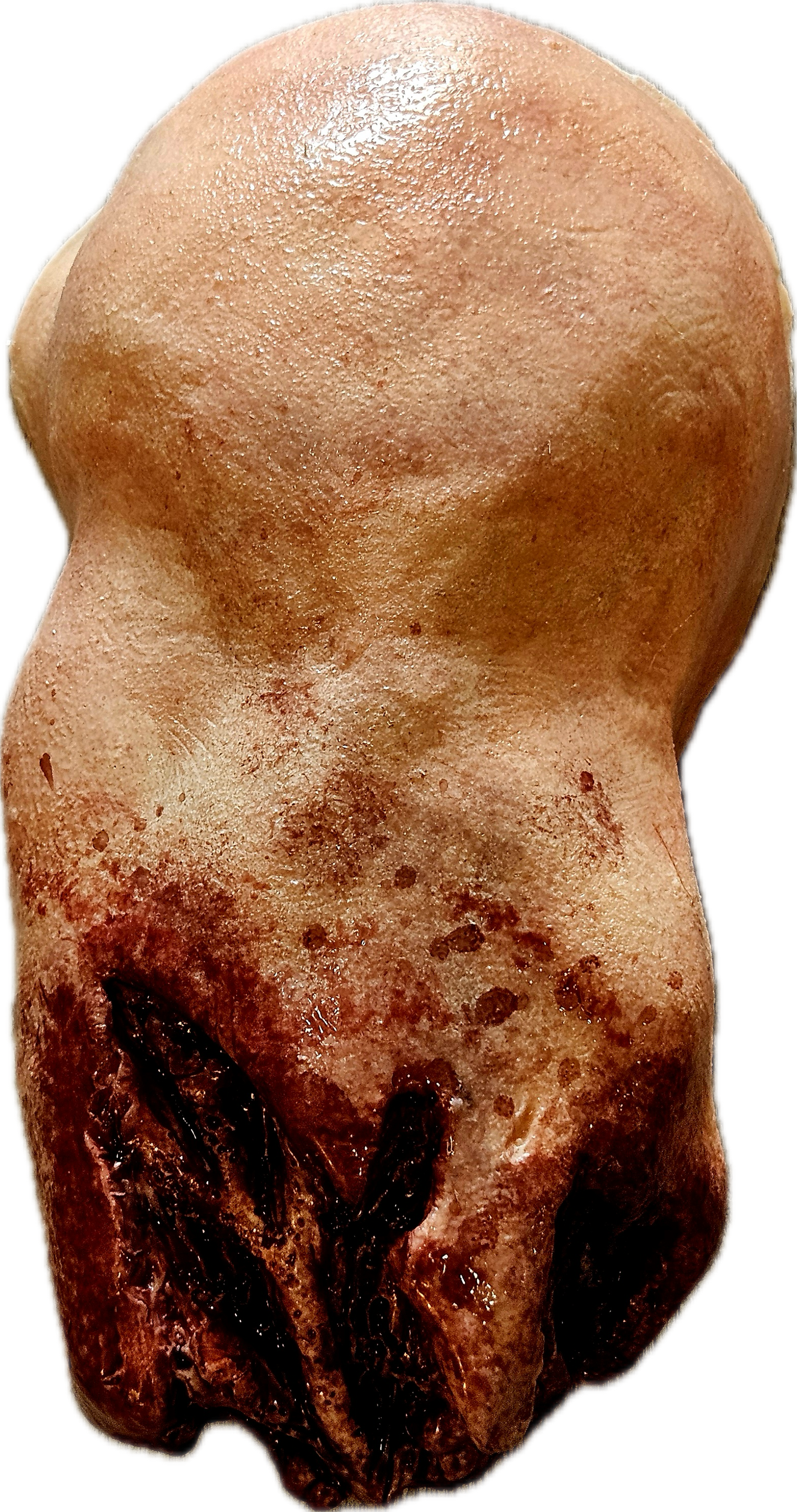 Amputated Upper Arm Prosthetic #101