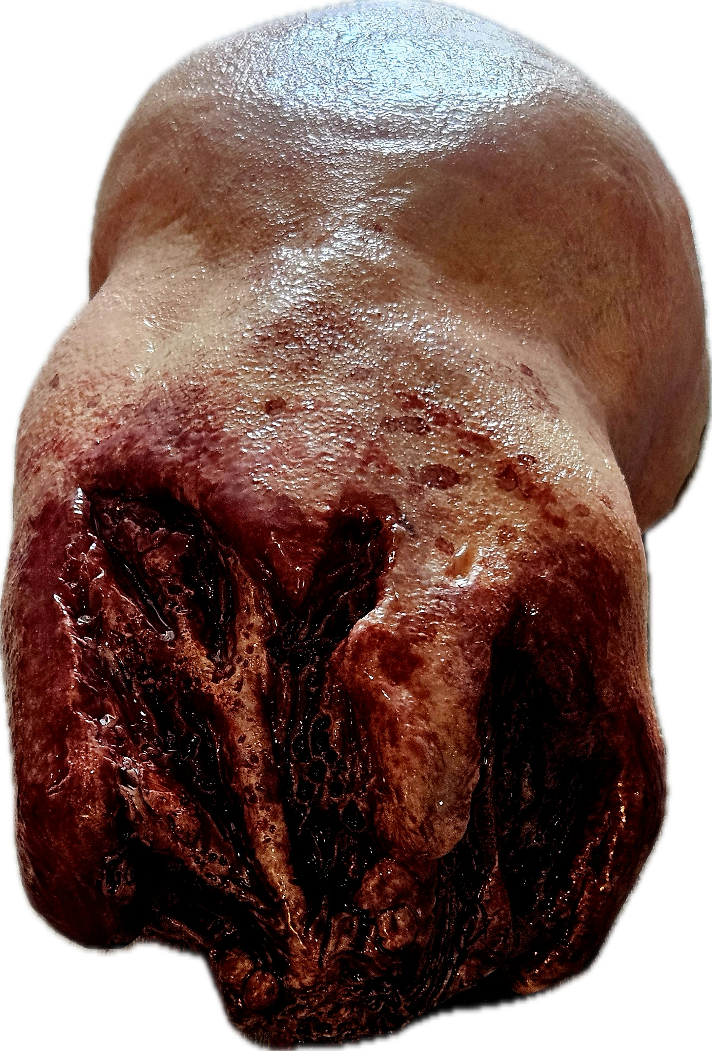 Amputated Upper Arm Prosthetic #101