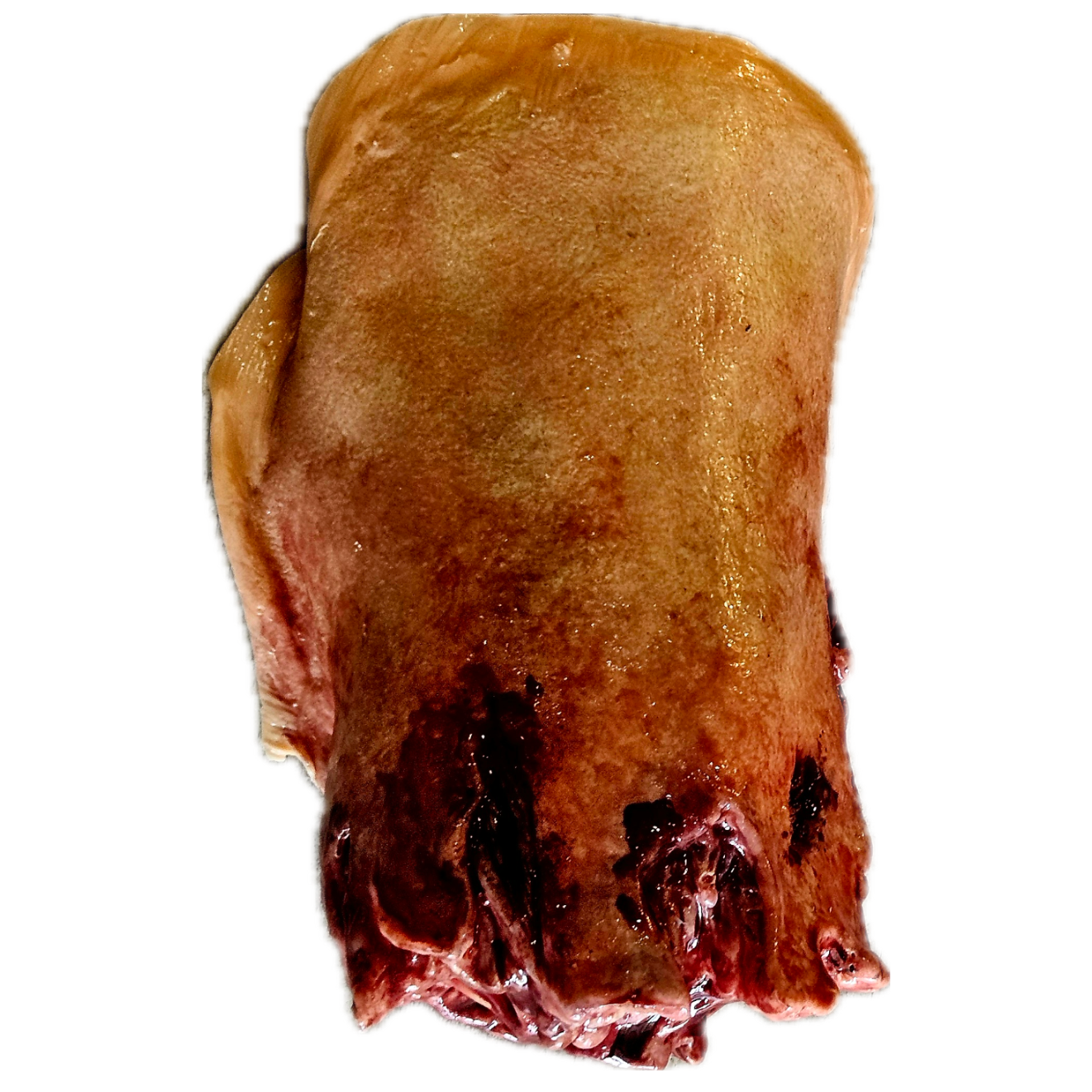 Amputated Upper Leg Prosthetic #102