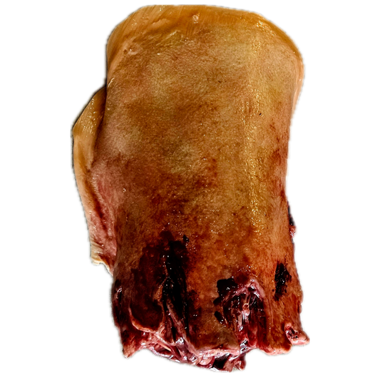 Amputated Upper Leg Prosthetic #102