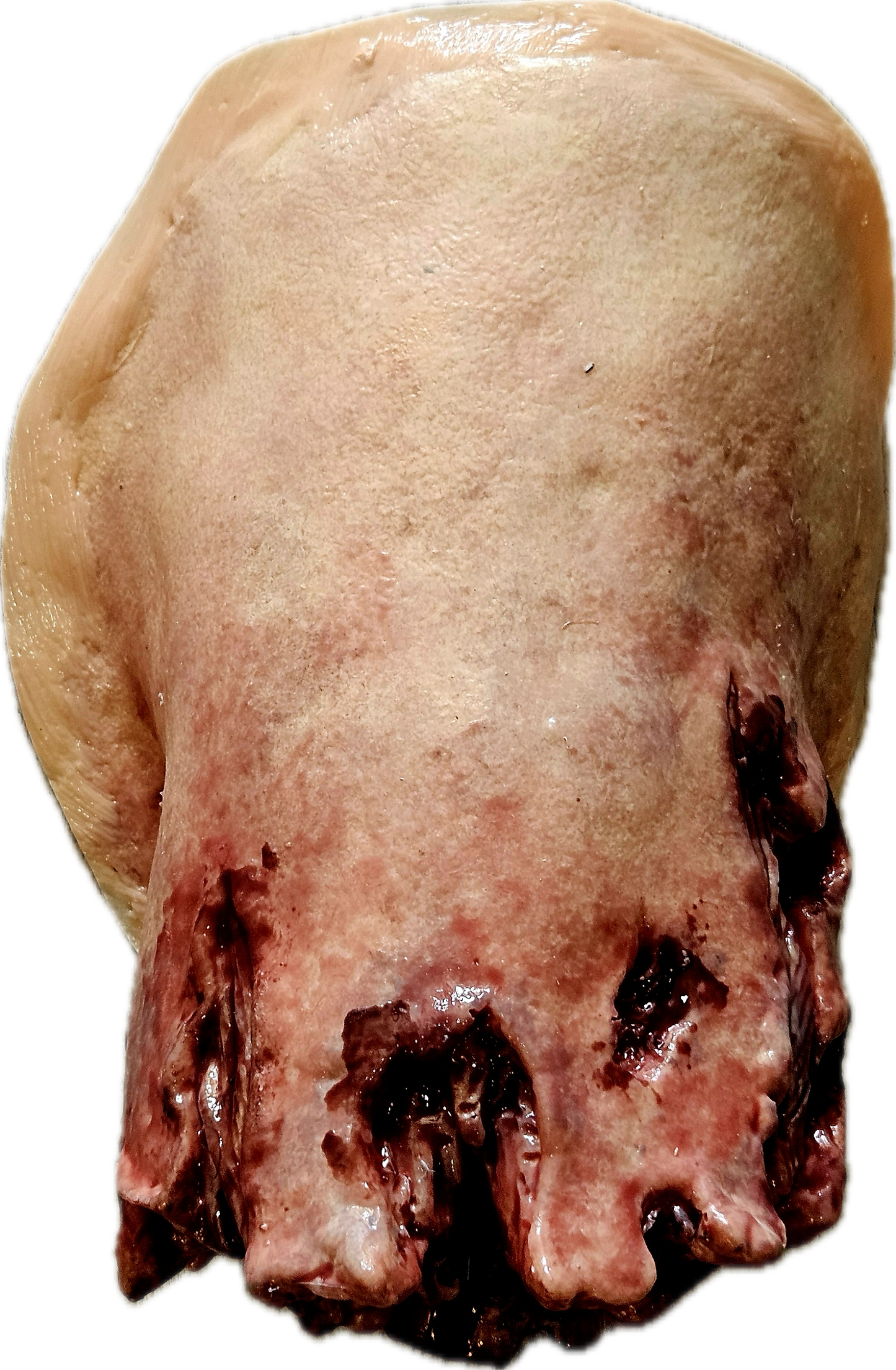 Amputated Upper Leg Prosthetic #102 Angle 1