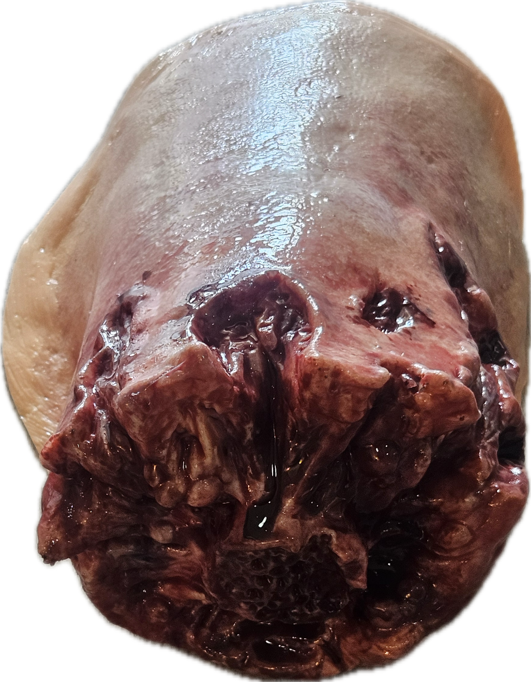 Amputated Upper Leg Prosthetic #102 Angle 2