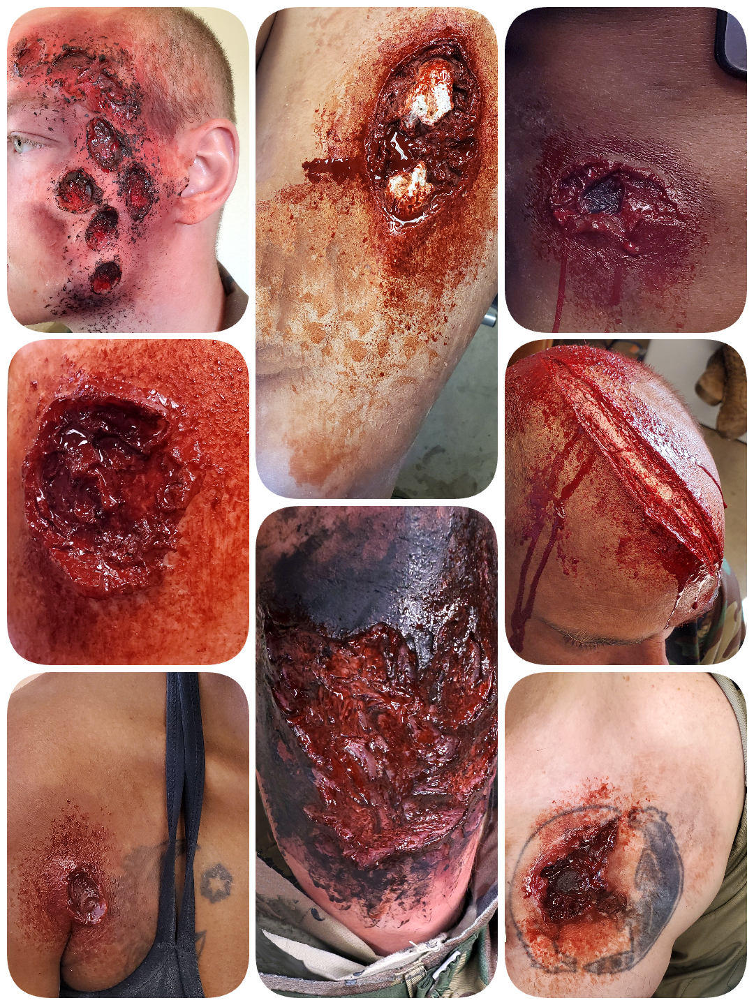 Moulage Wounds Collage